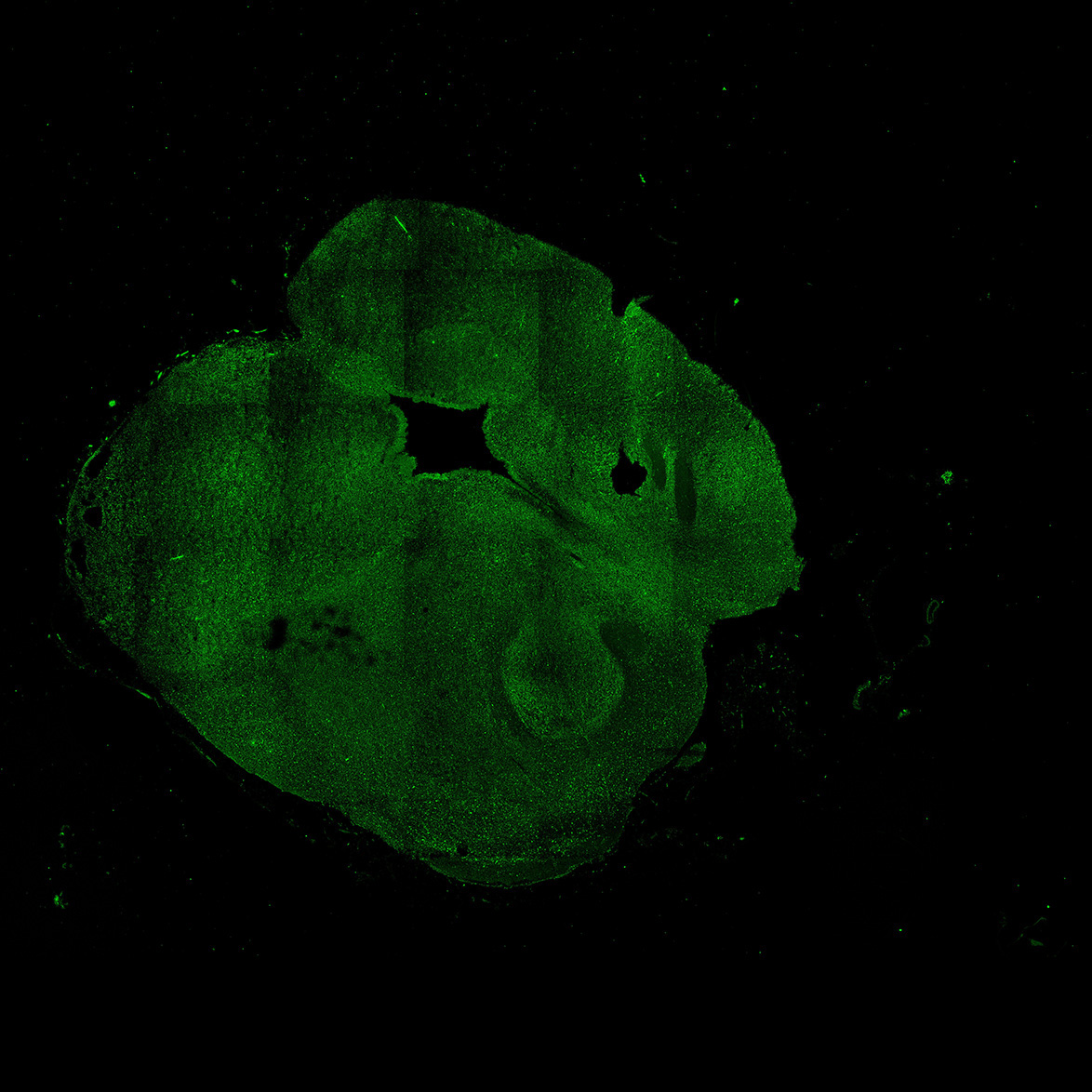 Human foetal midbrain